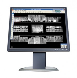 Pictures of digital xrays on a computer screen 