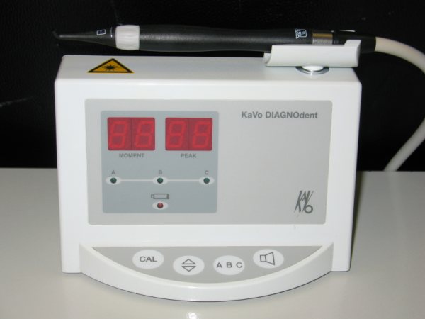 Prevent cavities with the Diagnodent