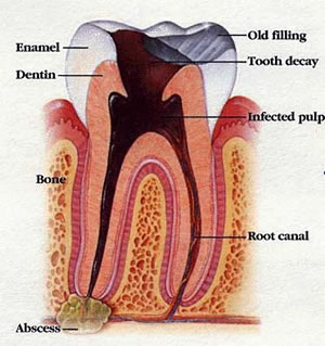 Diagram of Root Canal