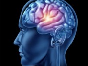 Picture of a human brain to represent the risk of stroke as a systemic effect from periodontal disease.