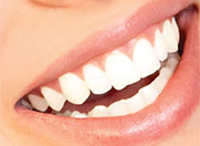PIcture of a smile showing teeth whitening.