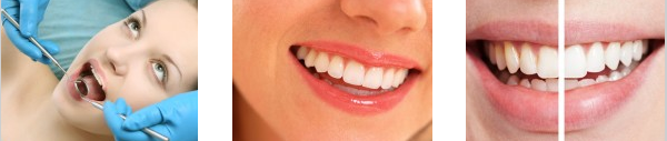 3pics Picture is a collage of scaling and root planing before and after picture showing gingivitis.