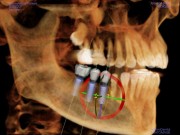 Cone Beam, CT Scan and 3-D Imaging