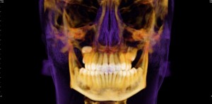 I-Cat Pic 2 ICAT picture of skull