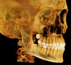 I-Cat Pic for Slideshow Precise 3d model of skull showing decay